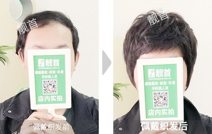 青年微烫自由式小面积大风吹不掉