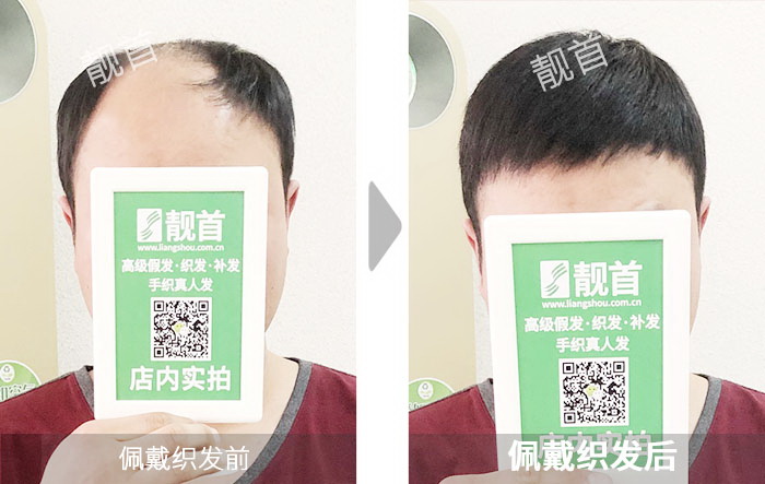 青年超短大面积大风吹不掉