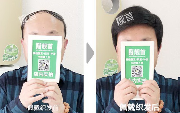 大面积中年自由式半头焕然一新