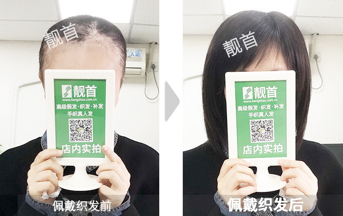 整体盖灰白青年变浓密大风吹不掉