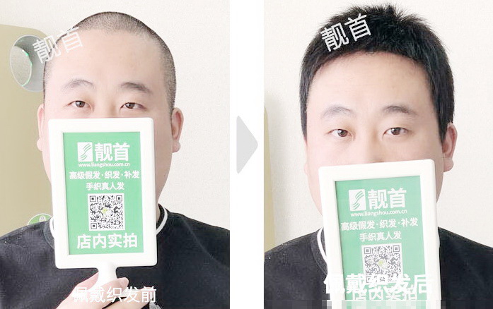 中年短寸光头长久使用