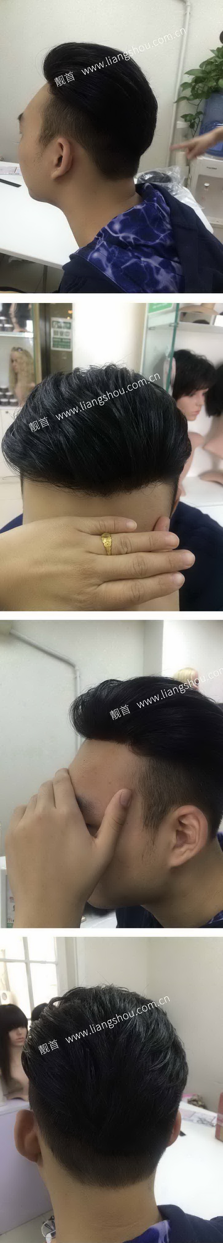 青年-背头男织发补发案例图