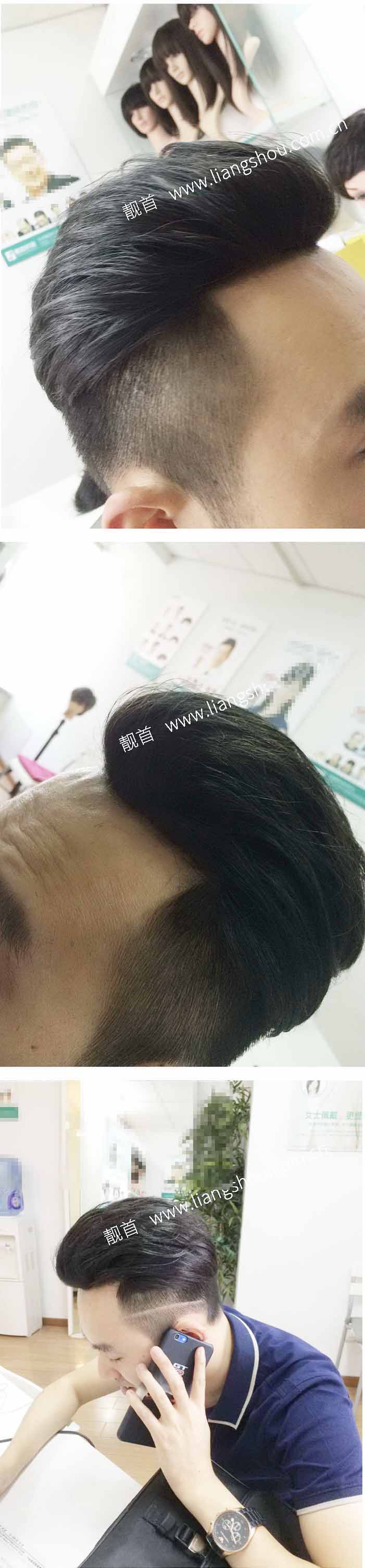 青年-背头-发块-男织发补发案例图