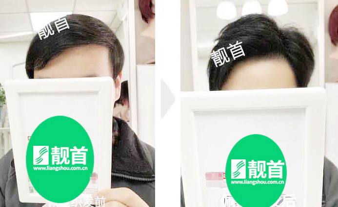 <b>大偏分中年局部发友口碑推荐</b>