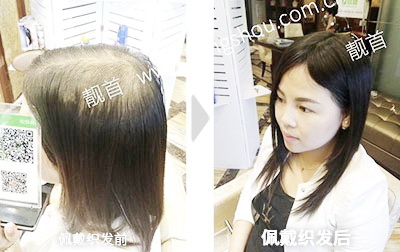 长直造型头顶稀少正面侧面多图